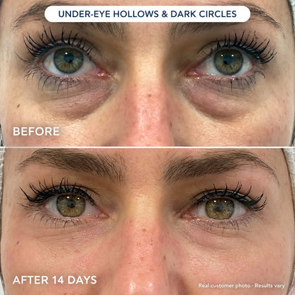 Novaris Fill Eye Cream