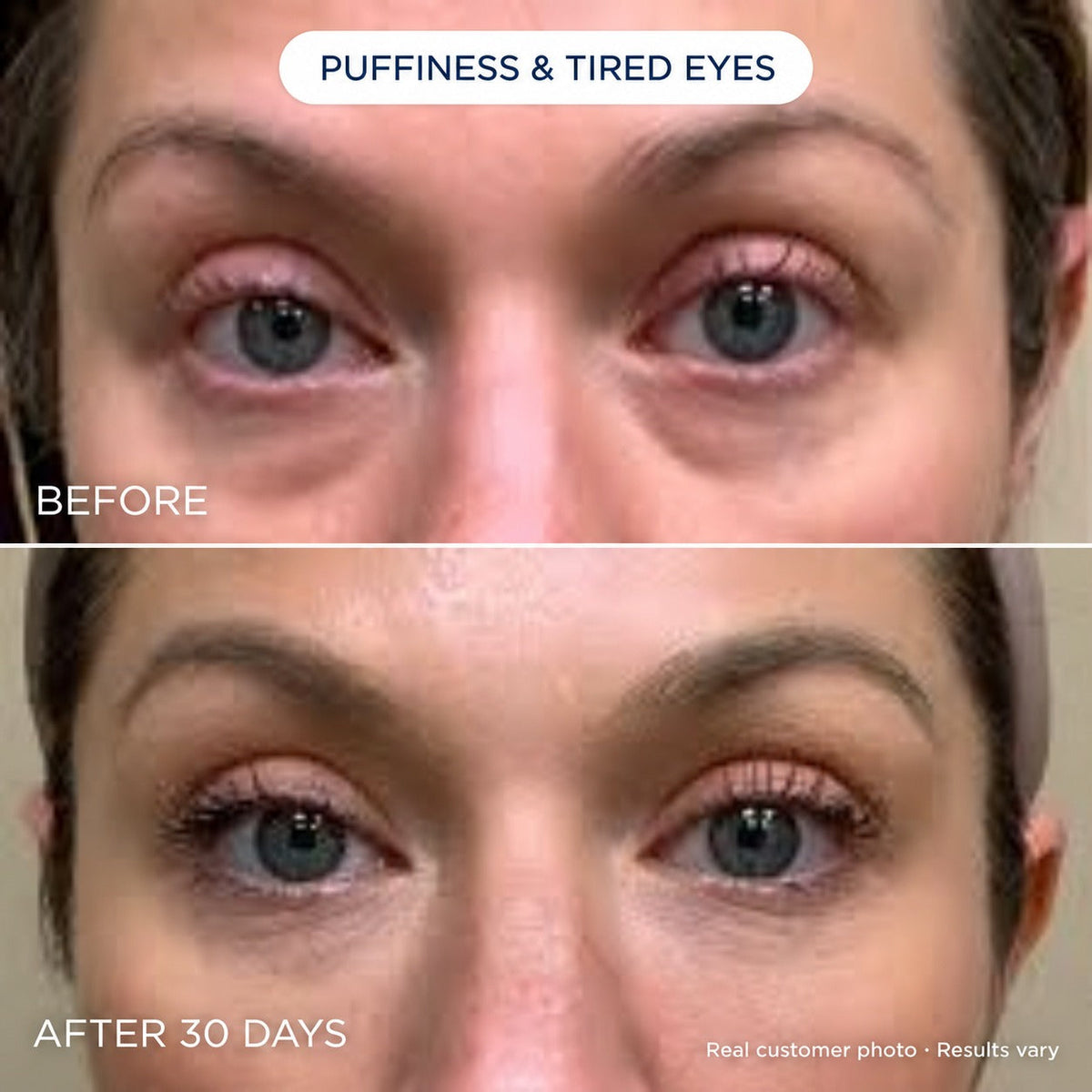 Novaris Fill Eye Cream