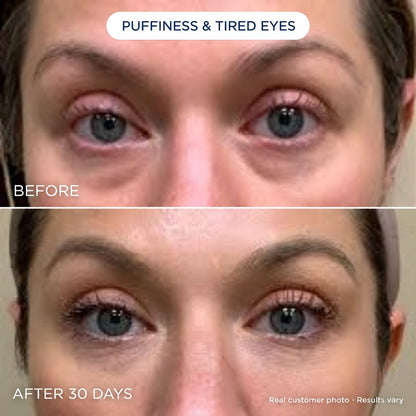 Novaris Fill Eye Cream