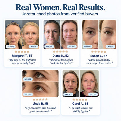 Novaris Fill Eye Cream