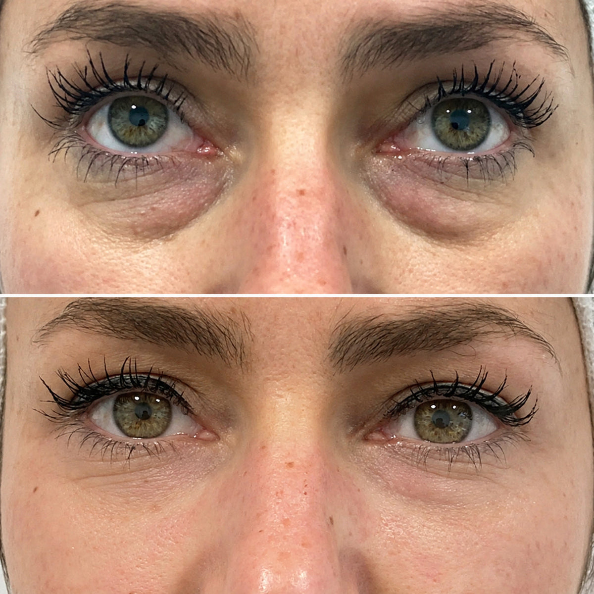 Before and after photo from Sarah M., 43 · Chicago, IL