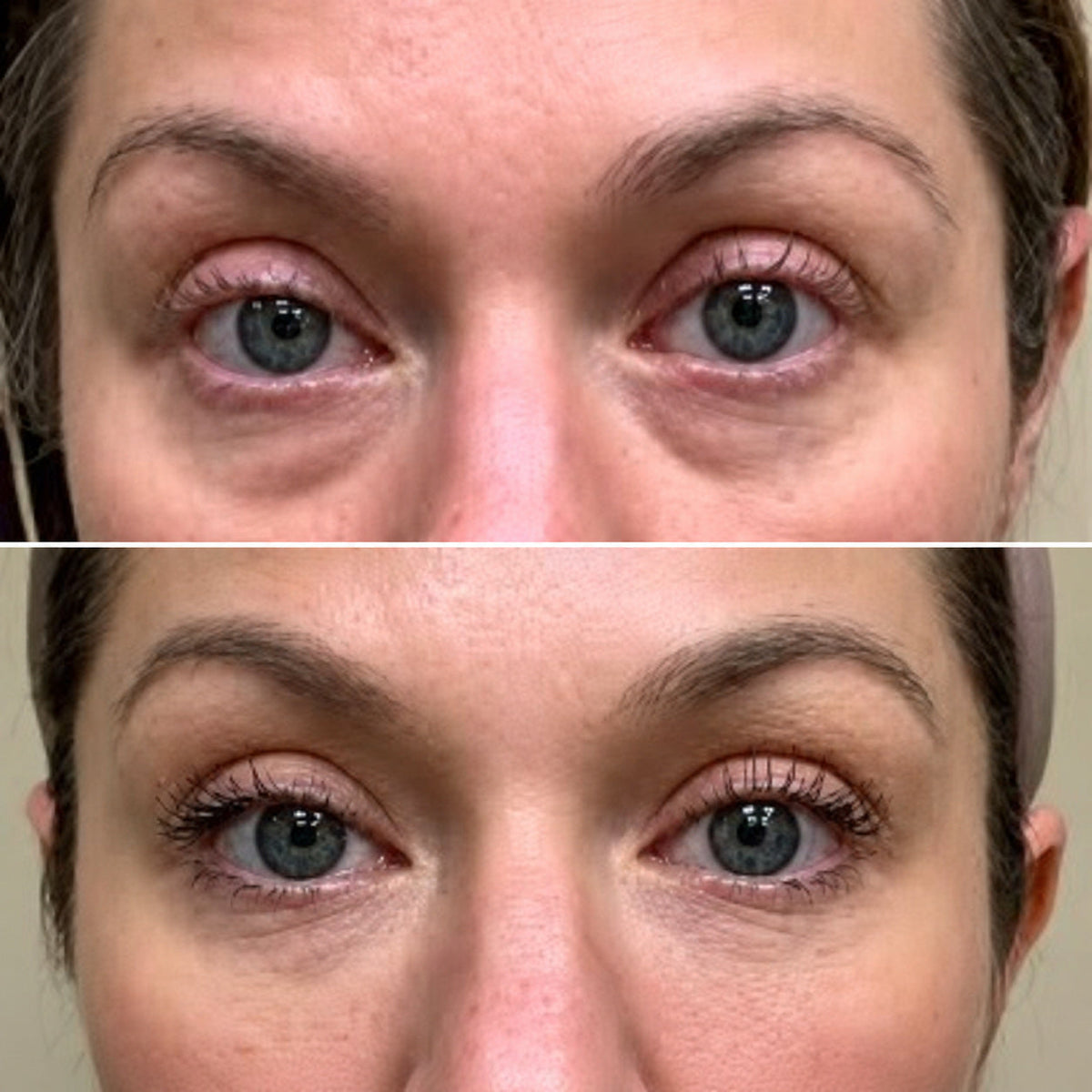 Before and after photo from Linda K., 47 · Austin, TX