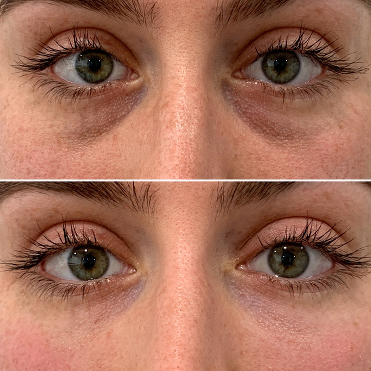 Before and after photo from Jenna B., 49 · Boston, MA