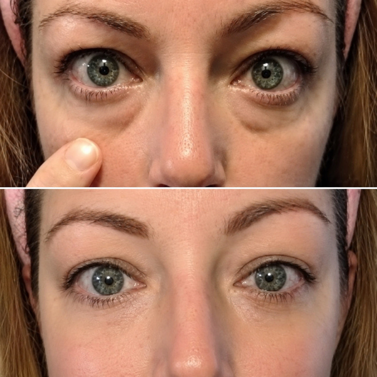 Before and after photo from Nicole P., 52 · Denver, CO